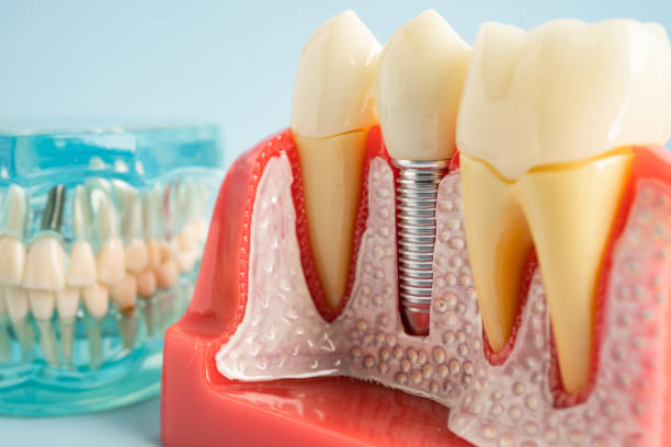 Professional  Dental Services in Overland Park, KS